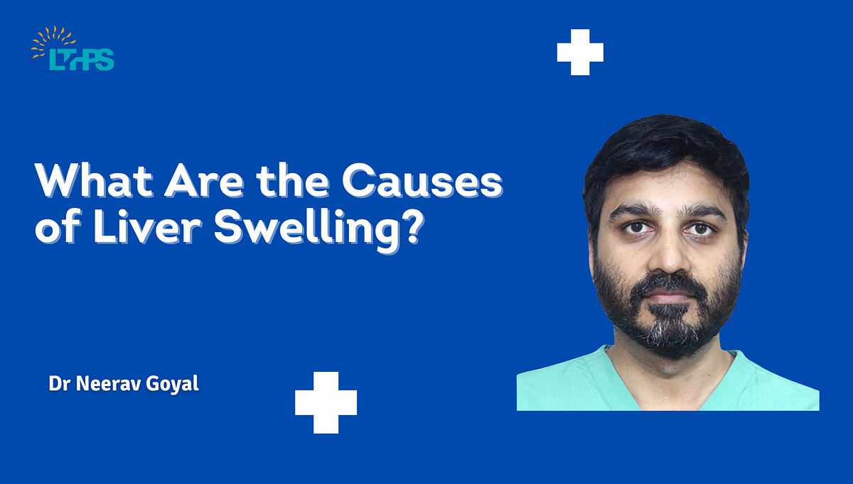 What Are the Causes of Liver Swelling? | by Transplantationliver | Oct, 2024 | Medium