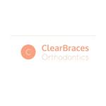 Clear Braces Orthodontics
